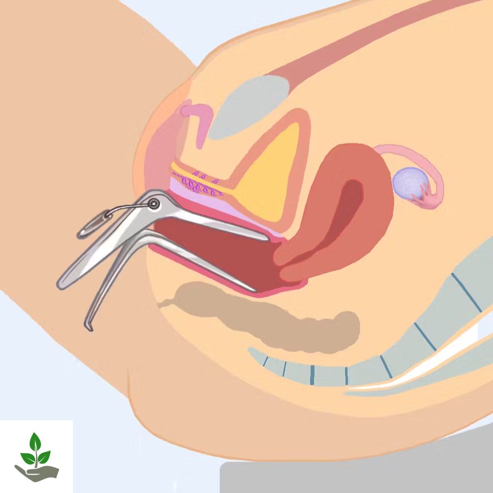 How a Speculum is Used