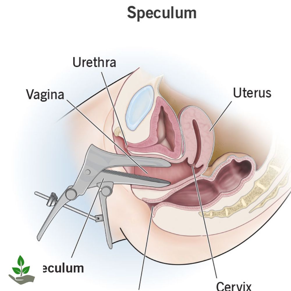 Speculum